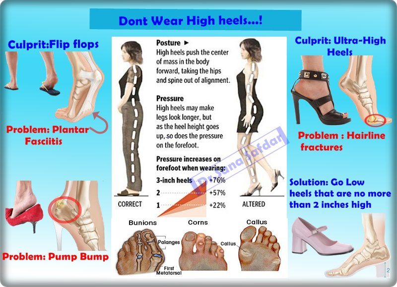 Dont-Wear-High-Heels