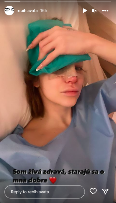 Rebeka po operácii nosa